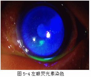 ZY016_20_5.gif